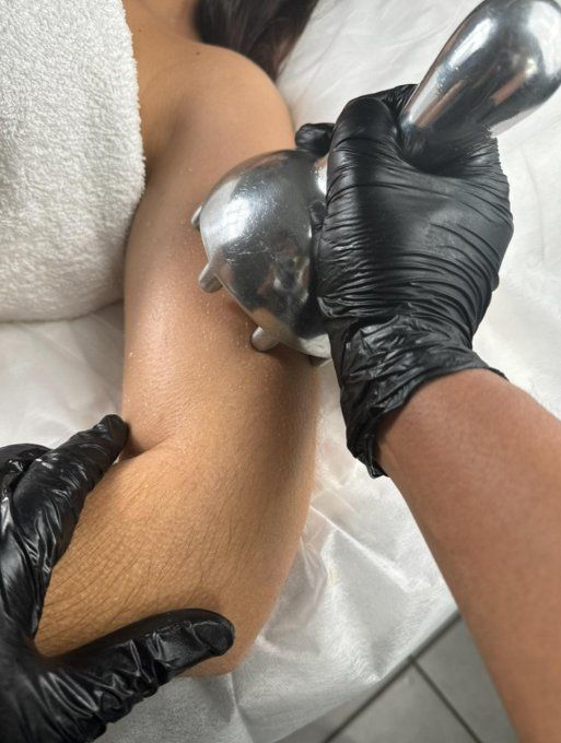 Cure de 5 séances madéro ice bras