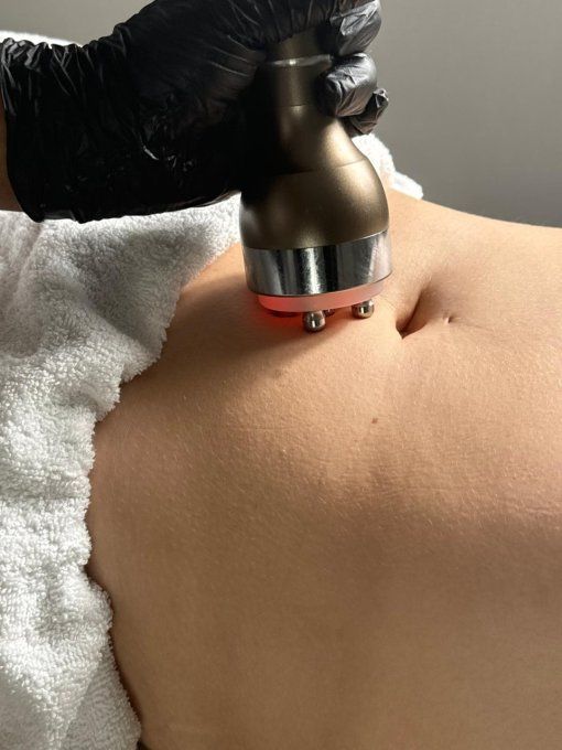 Séance lipocavitation + radiofréquence - 1 zone (ventre, cuisses, taille, etc...)