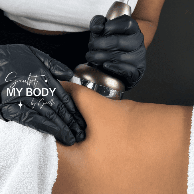 Cure de 10 séances lipocavitation corps - 1 zone (ventre, dos, cuisses, etc...) + 1 séance offerte