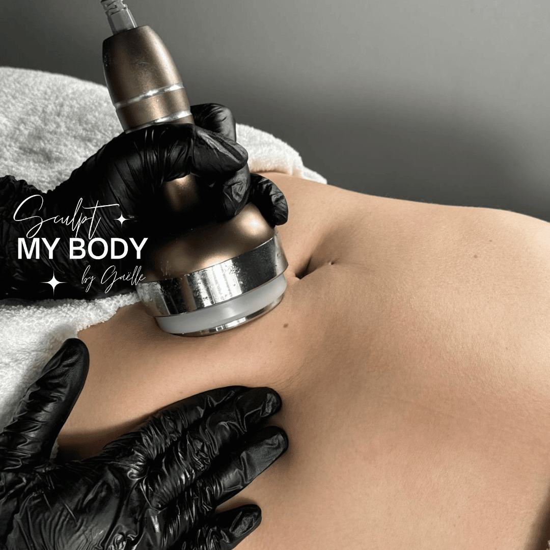 Lipocavitation